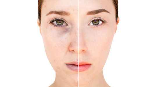 Beauty Without Filters: How to Keep It Real in a World of Instagram Perfection