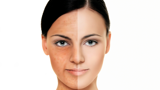 Magic Wands and Miracle Creams: How to Handle Clients Who Want Instant Results