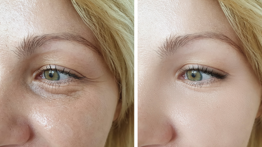 The Truth About "Instant Results" in Beauty Treatments: What to Really Expect