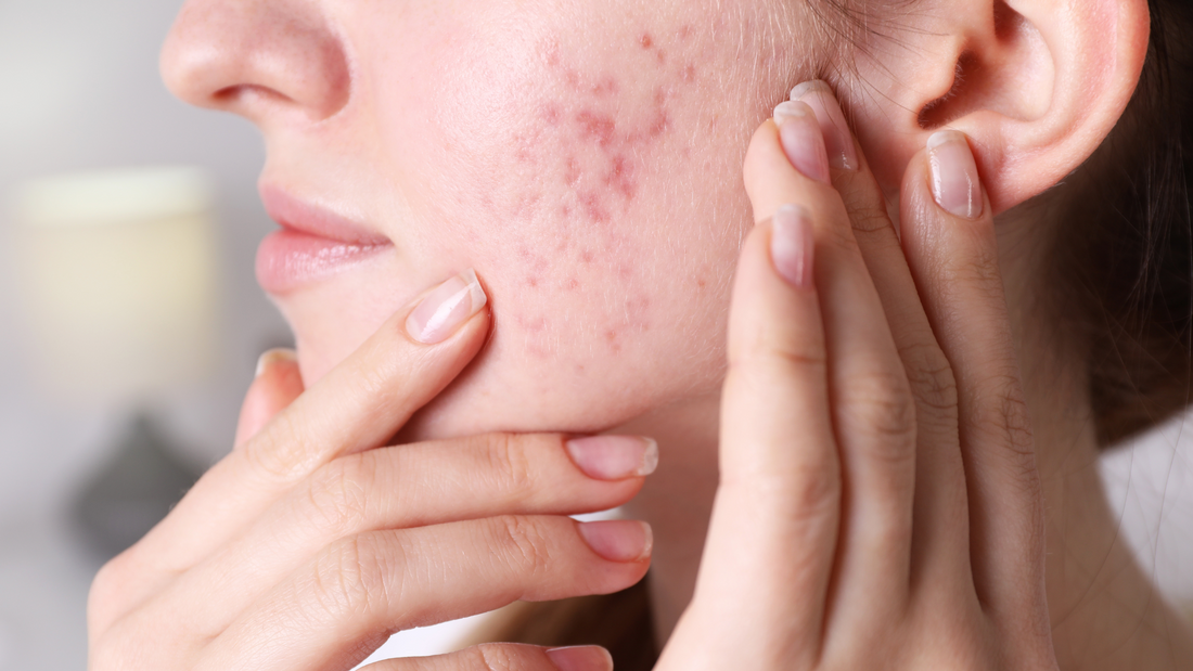 Beauty Services and Hormonal Changes: What Clients Need to Know (But Are Too Embarrassed to Ask)